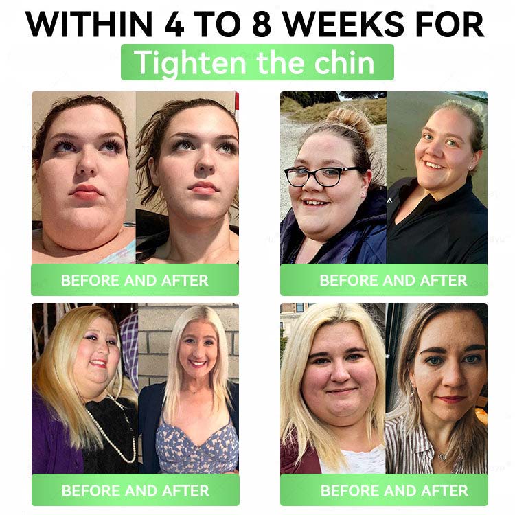 🔥Official Store| 🧑‍⚕️Alcuras® Moringa × Berberine × AMPK 8-Benefit Slimming & Metabolic Nano Microneedle Patch 🇺🇸 Just once a day · Visible changes in 7 days ✅ For obesity, loose skin, diabetes, sleep apnea, joint issues, and more
