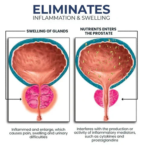 Alcuras™ Nasal Inhaler for Prostate Health-Regain Your Confidence✨