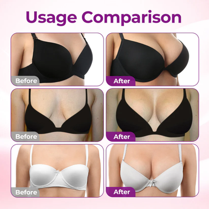 🍓T Alcuras®  🦪Targeted Breast Enhancement Advanced Nano Microneedle Patch💃